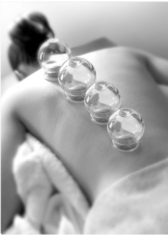 Chinese cupping is the most effective deep tissue massage you can get 
