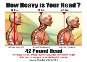 forward-head-posture